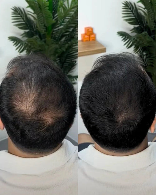 Cache-Cheveux Minéral — photo d'un client 1